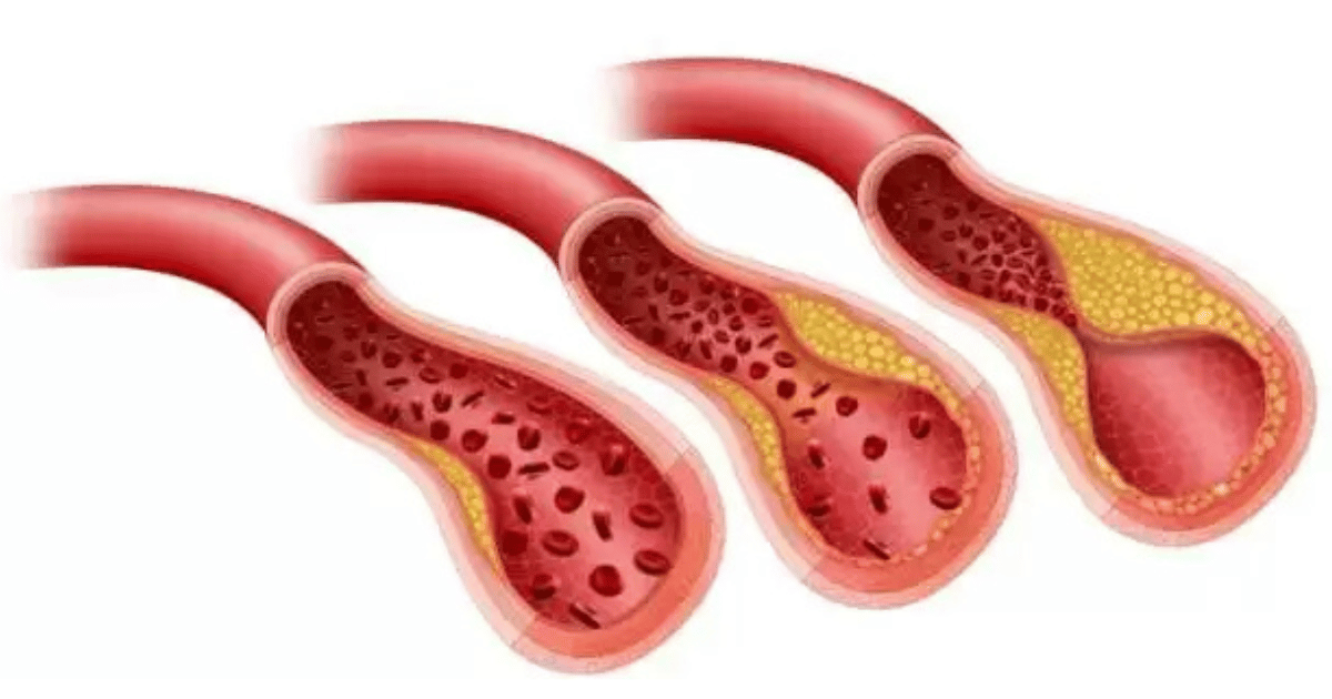 Succo di barbabietola